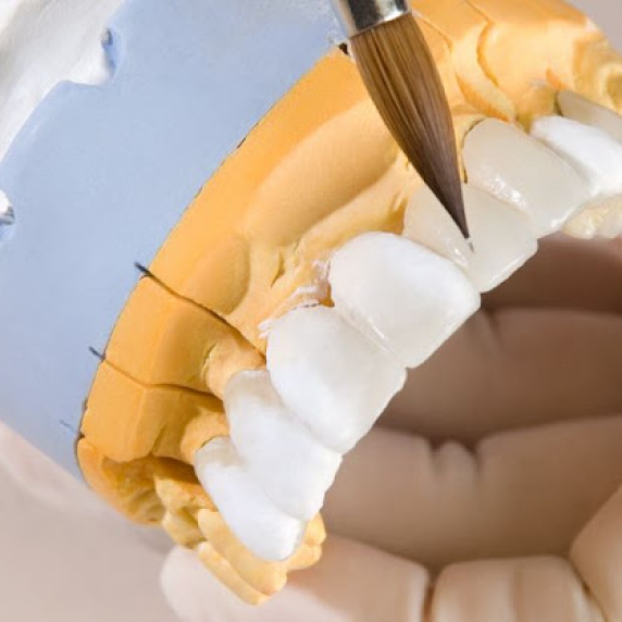 Trabajo Dental 1