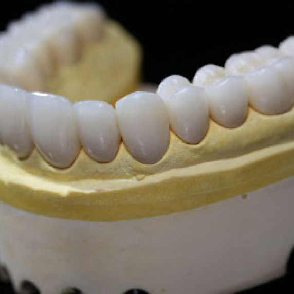 Trabajo Dental 3